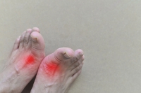 Specific Foods Can Be Linked to Gout Attacks