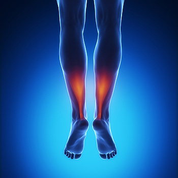 Foot with Achilles tendon injury