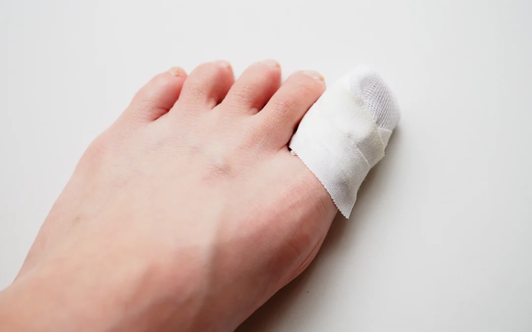 Important Facts About Broken Toes
