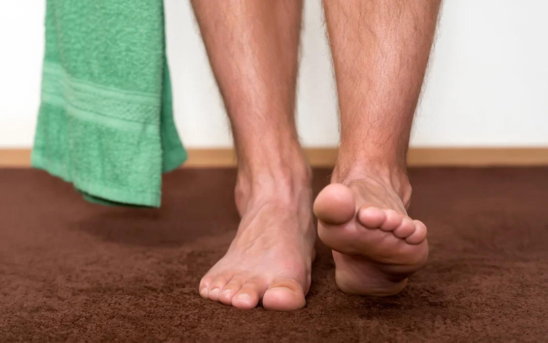 What To Do If You Keep Developing Athlete’s Foot
