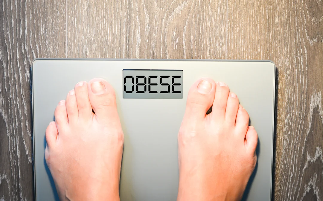 How Obesity Negatively Affects Your Feet