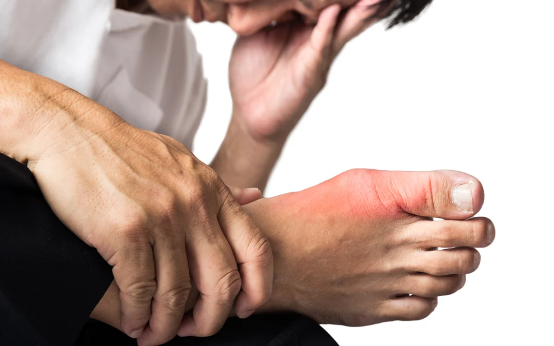 Gout 101: Understanding Symptoms and Causes
