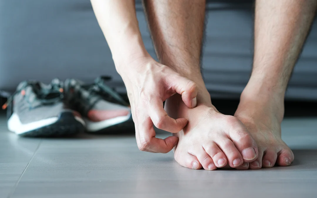 Frequently Asked Questions About Athlete’s Foot