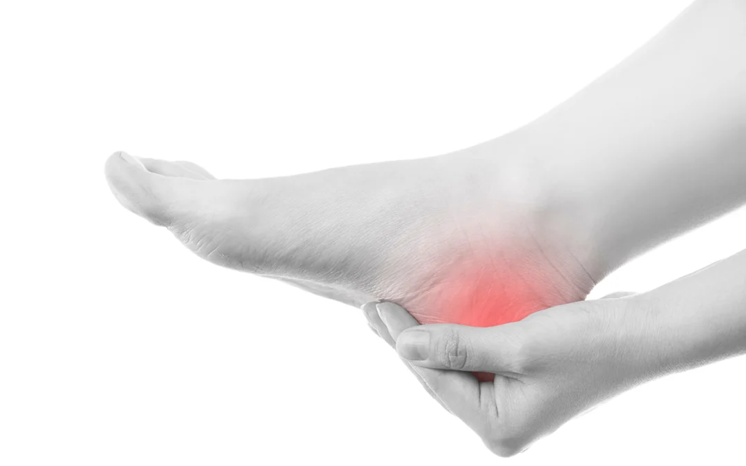 Understanding Painful Plantar Fasciitis