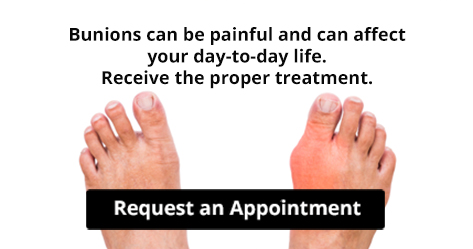 bunions treatment