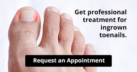 ingrown toenail treatment
