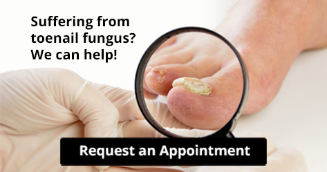 toenail fungus