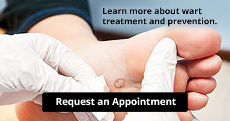 request an appointment plantar warts image button