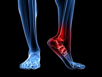 Foot experiencing tingling sensation from tarsal tunnel syndrome