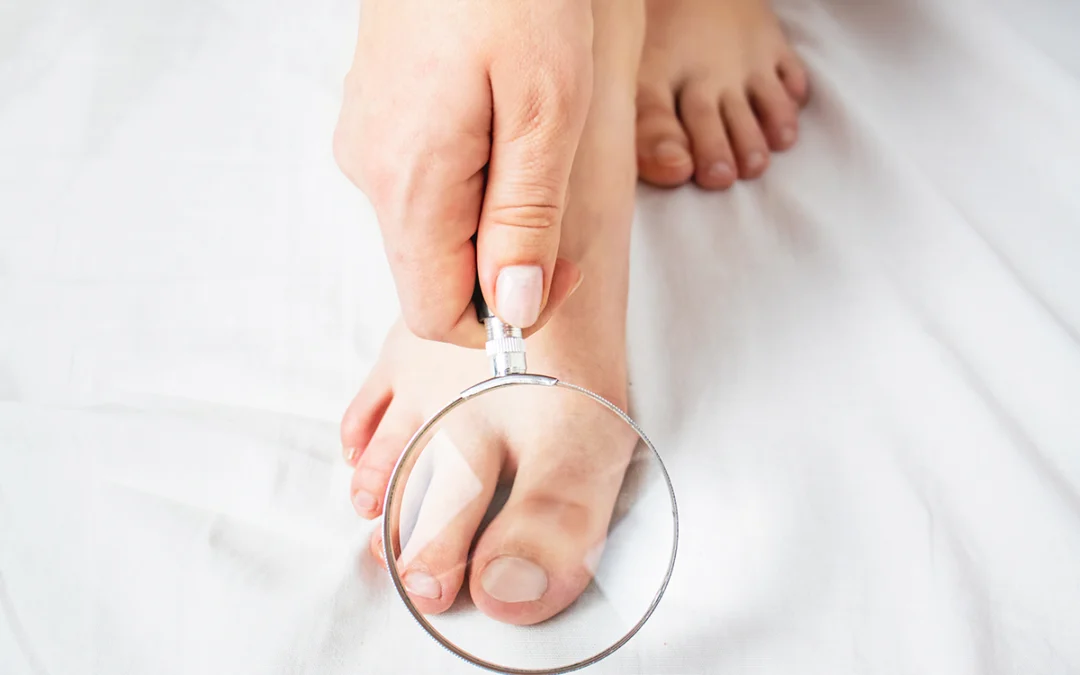 It’s Time to Take Care of Your Beautiful Feet