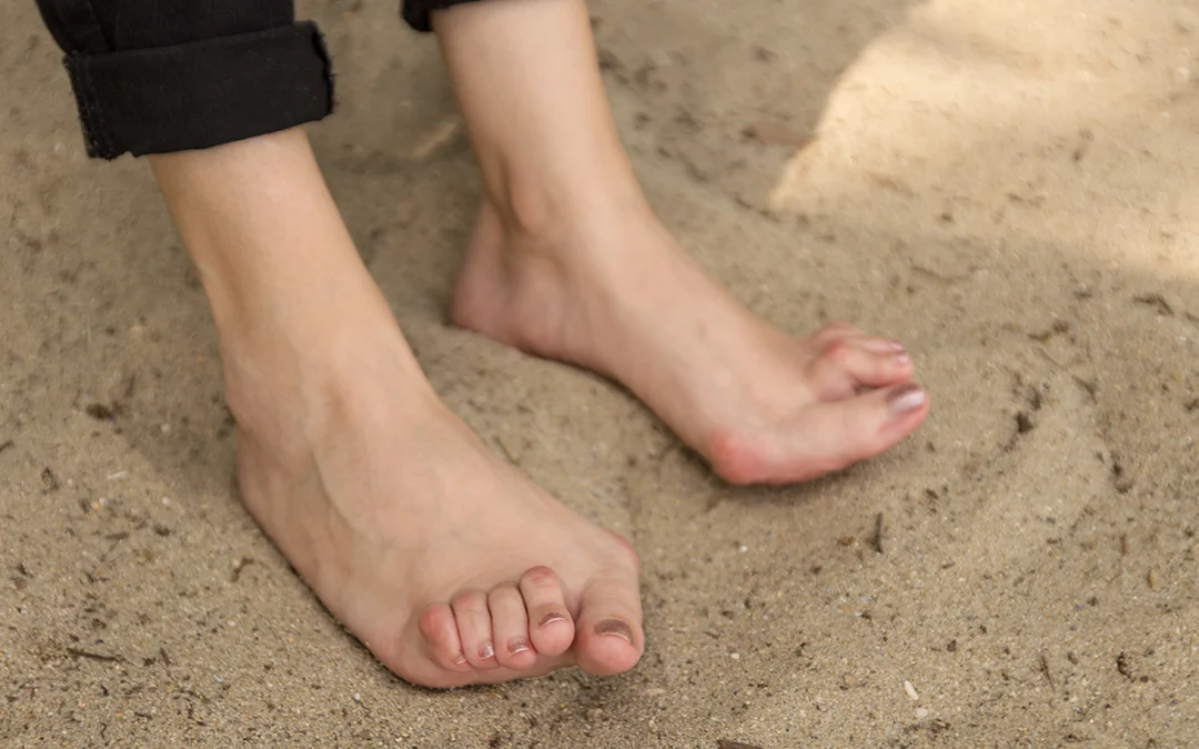 Which Toes Are Affected by Hammertoe and Why