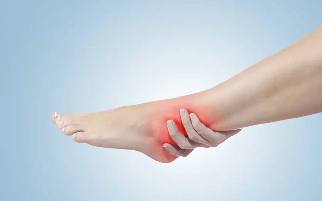 Types of Ankle Sprains You Should Know About