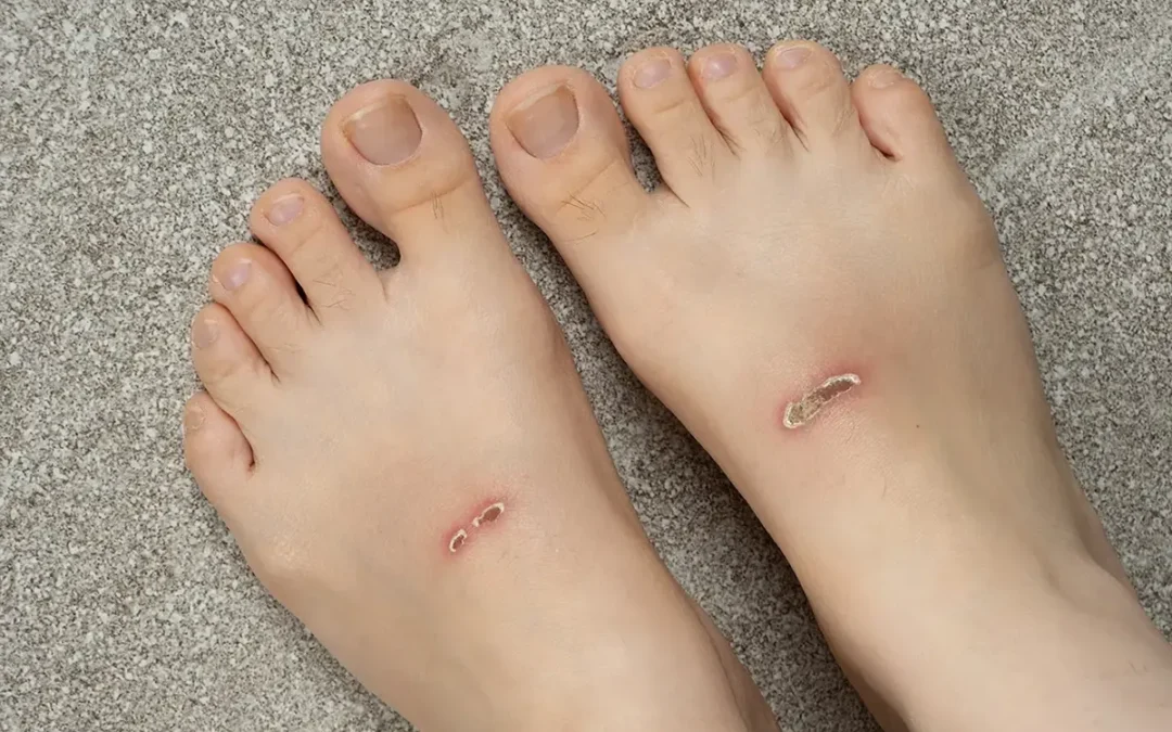 When Wounds Don’t Heal, See a Specialist