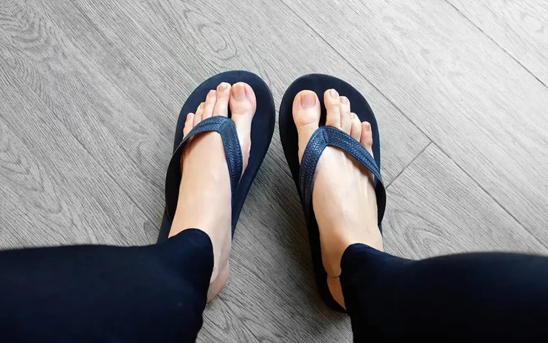 Flip-Flops and Your Feet: What to Know