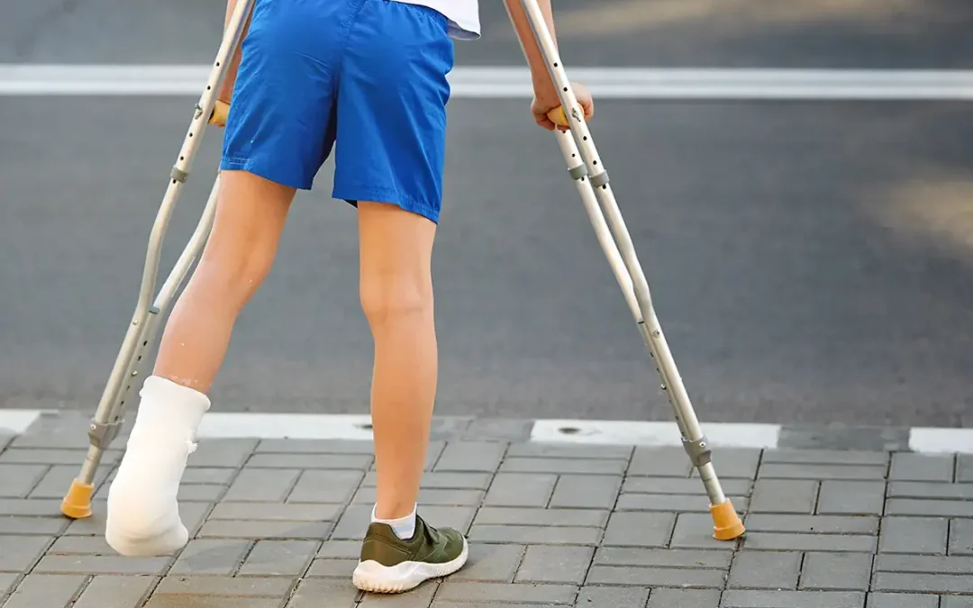 What You Should Know About Ankle Avulsion Fractures