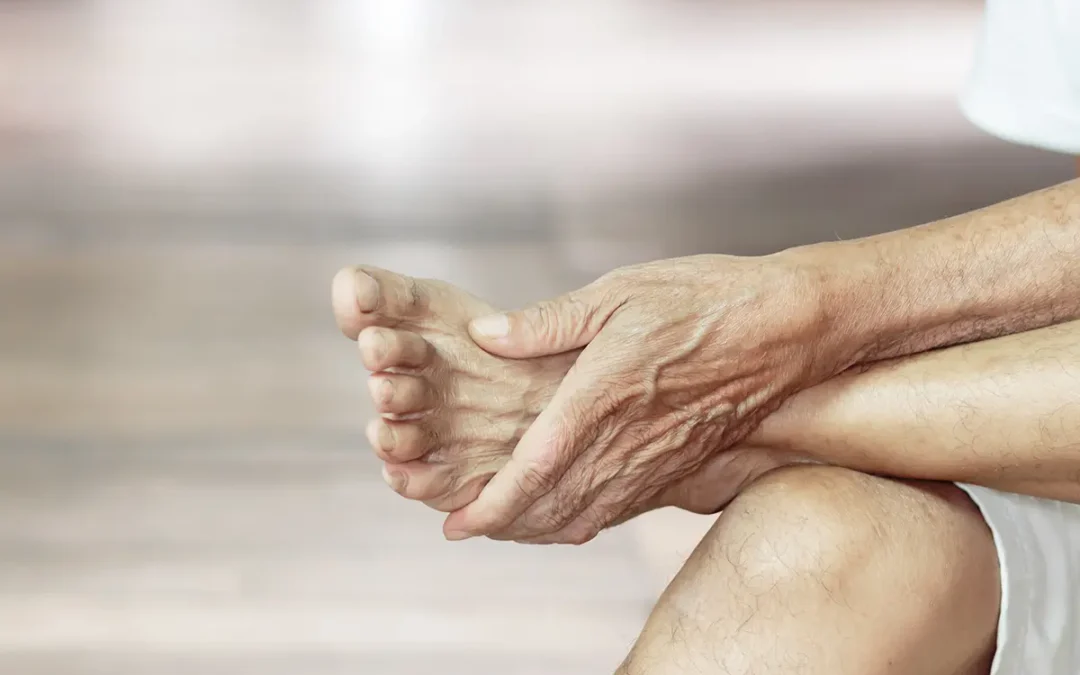 Common Foot Conditions That Affect Seniors and How to Manage Them