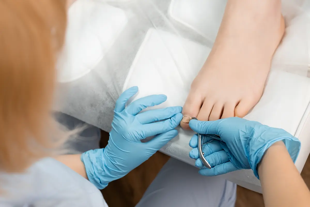 close up of a pedicure master is cutting and removing ingrown toenail on a female foot in a nail salon close up of a pedicure master is cutting and removing ingrown toenail on a female foot in a nail salon