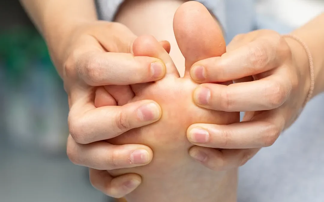 Athlete’s Foot Facts: What Everyone Should Know to Prevent It