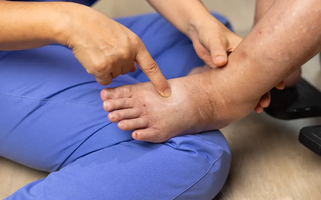 Diabetes and Foot Problems: What Every Patient Should Know