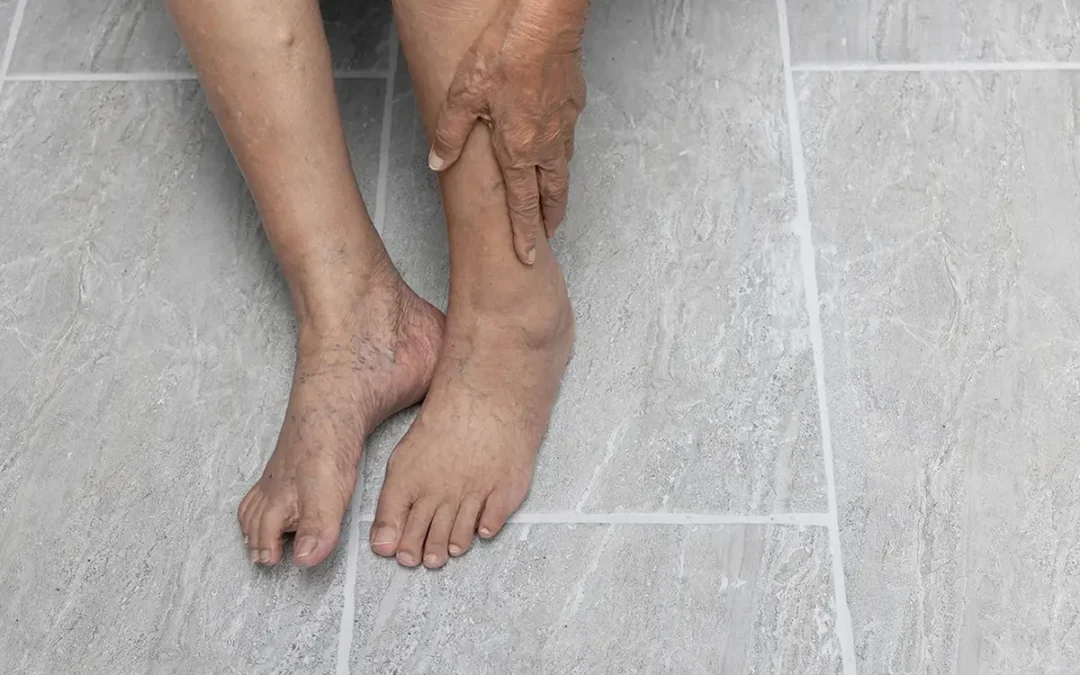 Vascular Foot Testing for Diabetics: Protecting Your Circulation