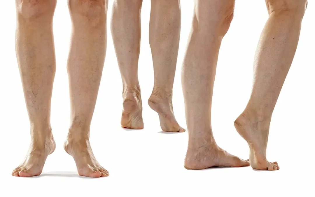 Causes, Symptoms, and Treatment of Poor Blood Circulation in the Feet