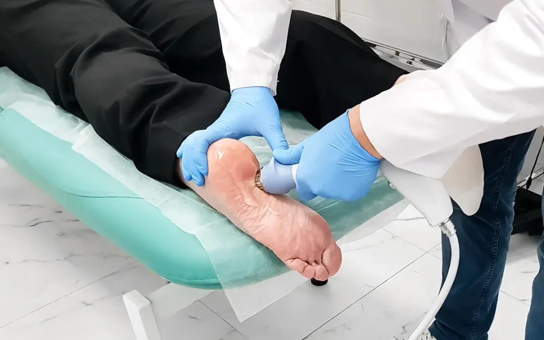 What Is Extracorporeal Shock Wave Therapy (ESWT)? A Closer Look
