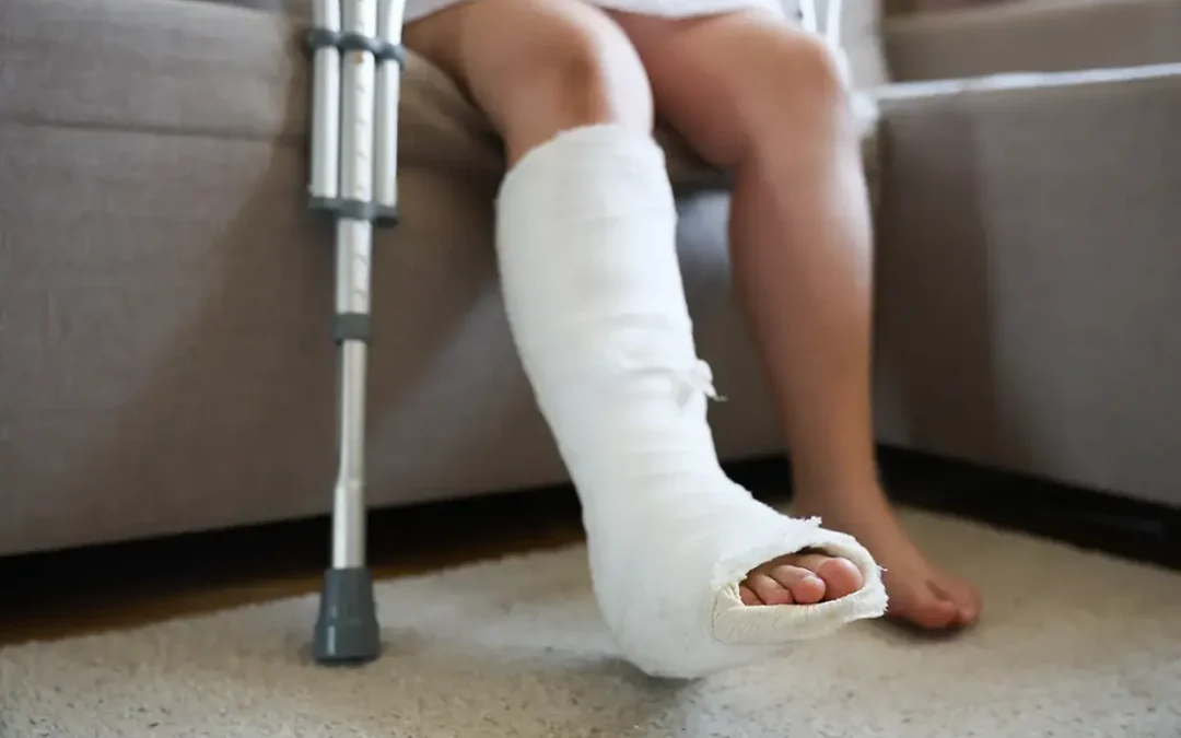 Stress Fractures 101: What They Are and How to Heal Properly