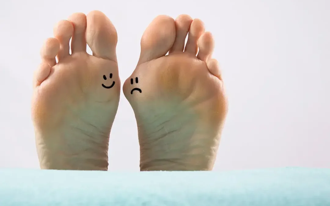 Are Bunions Genetic? Exploring the Role of Family History