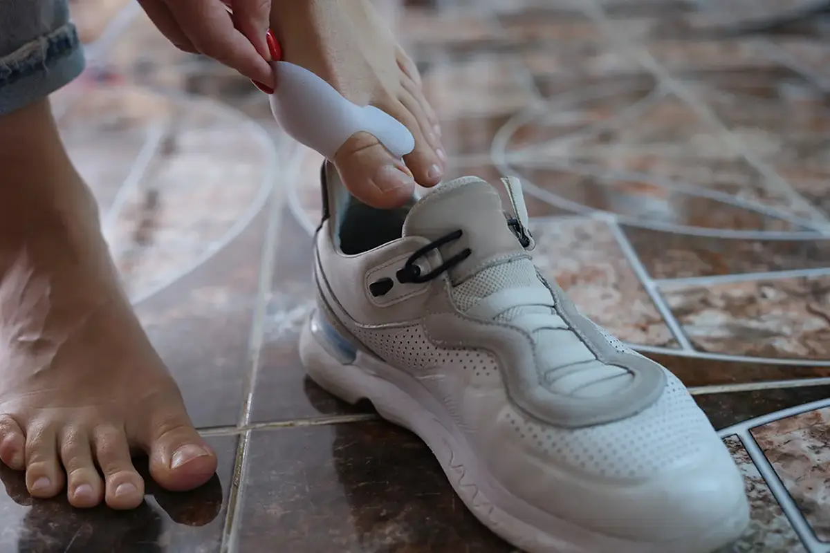 hallux valgus on women legs with lock puts on sneaker hallux valgus on women legs with lock puts on sneaker