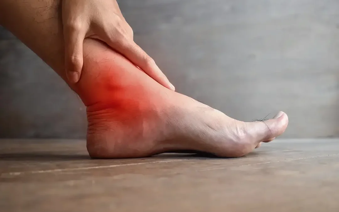 Symptoms of an Achilles Tendon Injury: When to Seek Help