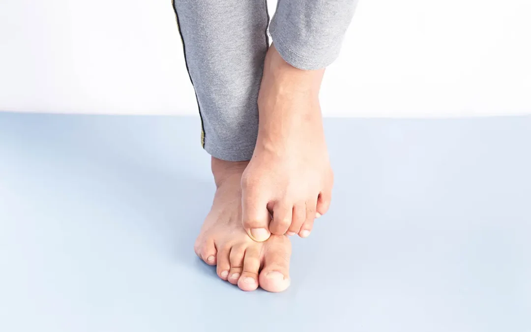 Athlete’s Foot: Causes, Symptoms, and Effective Treatments