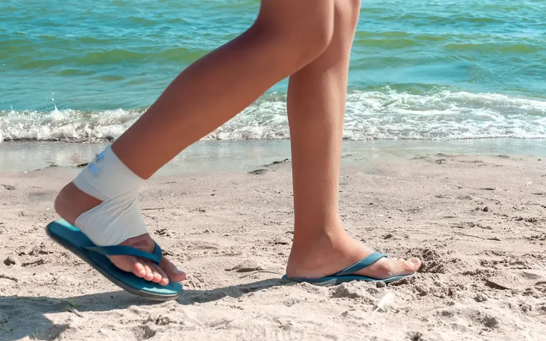 Foot Conditions Resulting From Wearing Flip Flops