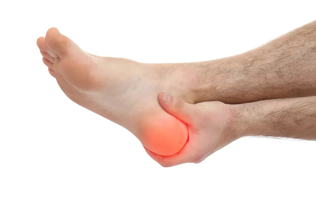Plantar Fasciitis and Other Heel Pain Causes: A Comprehensive Guide