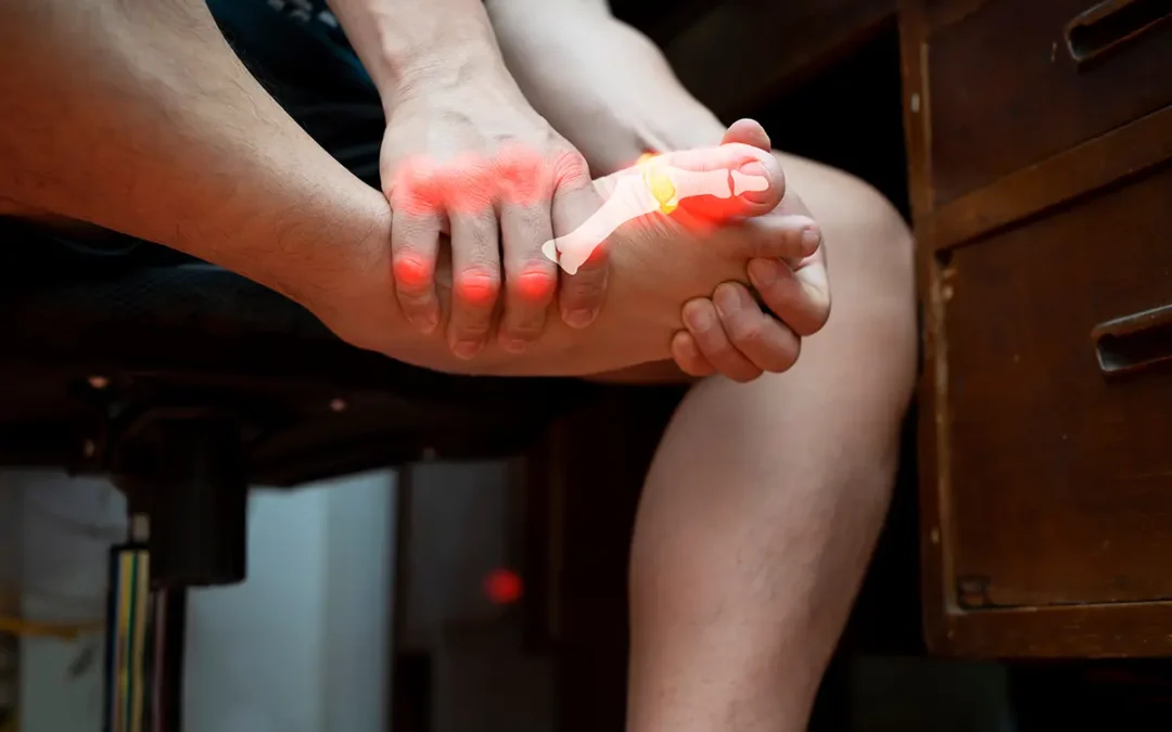 Managing Gout Pain: Effective Strategies and Tips