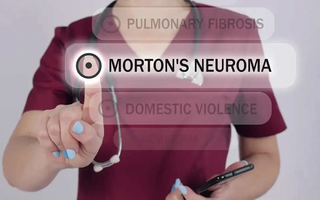 Morton’s Neuroma: What You Need to Know