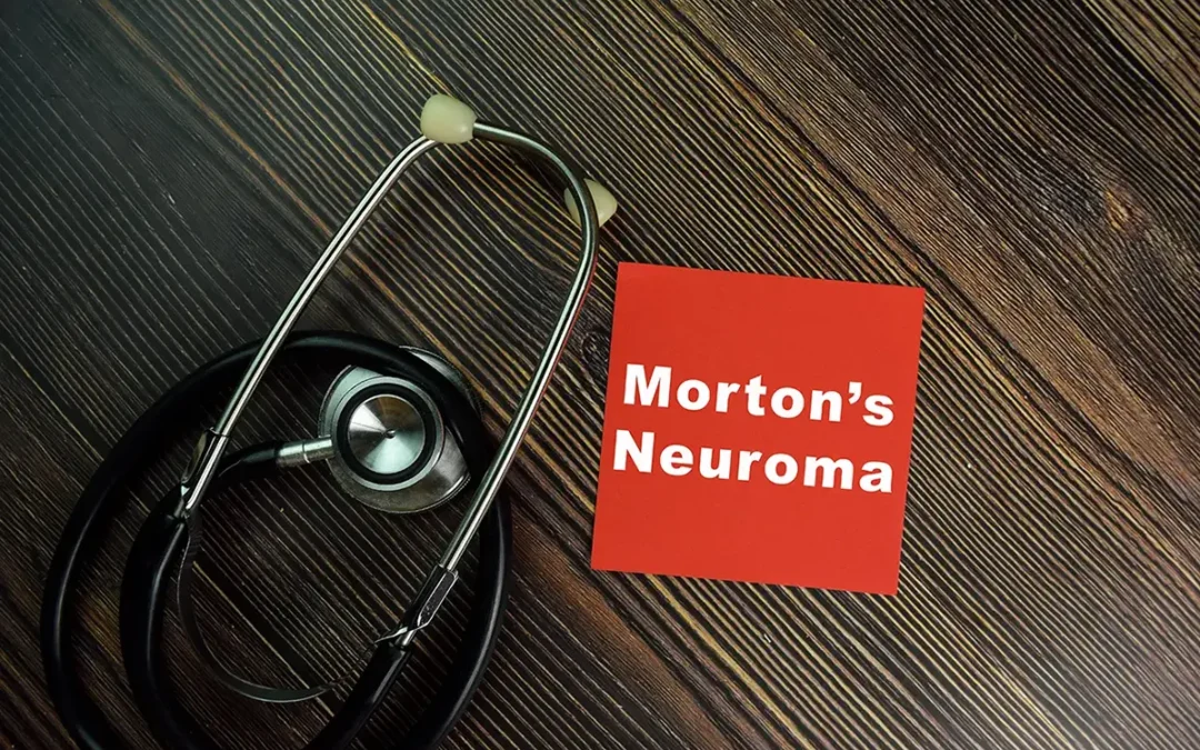 Finding Relief from Morton’s Neuroma: Treatment Options That Work