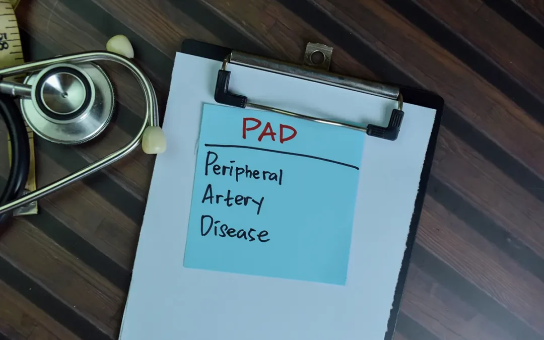 Symptoms of Peripheral Artery Disease Affecting Your Feet