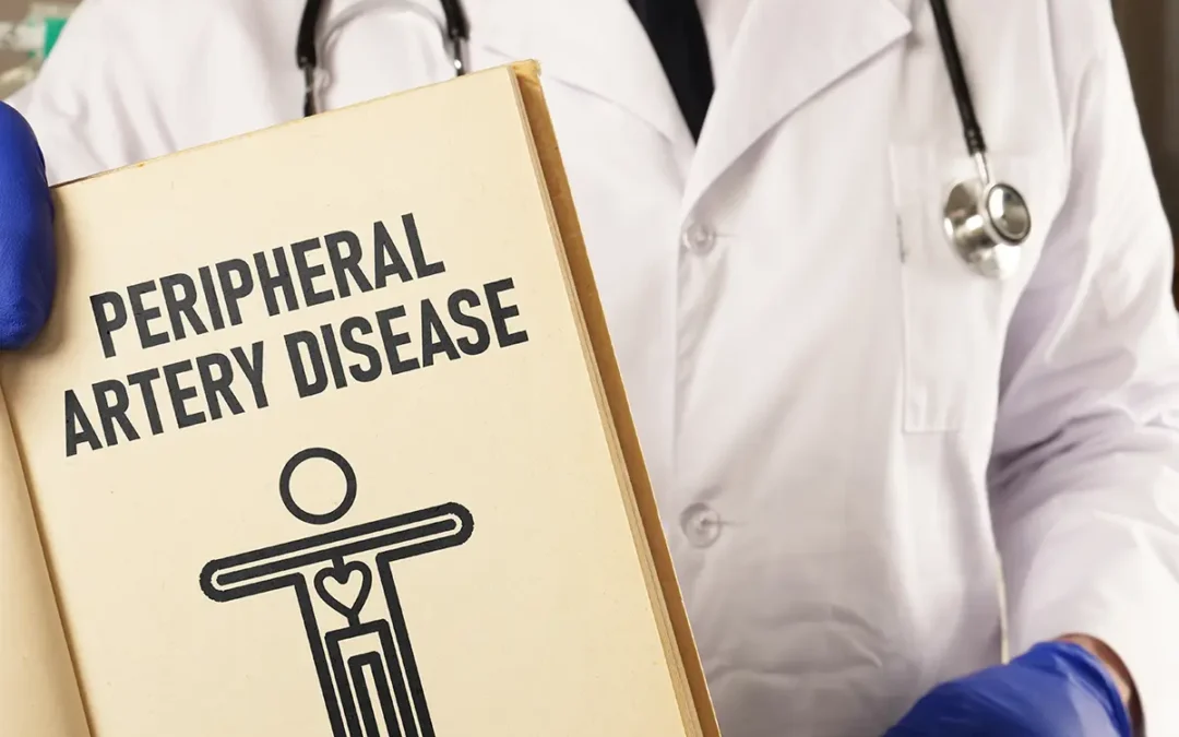Recognizing Signs of Peripheral Artery Disease Early to Save Your Limbs