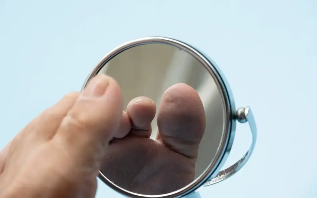 Diabetic Foot Conditions: What to Look For and How to Manage Them