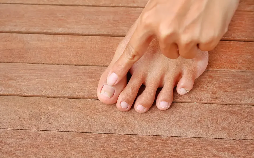 What Is Toenail Fungus and How to Manage It