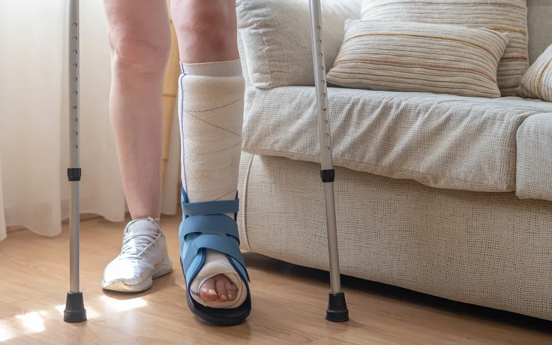 Risk Factors for Foot Stress Fractures and How to Prevent Them