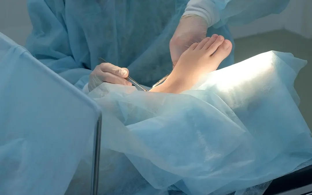 Foot Surgery: When Is It Necessary and What to Expect