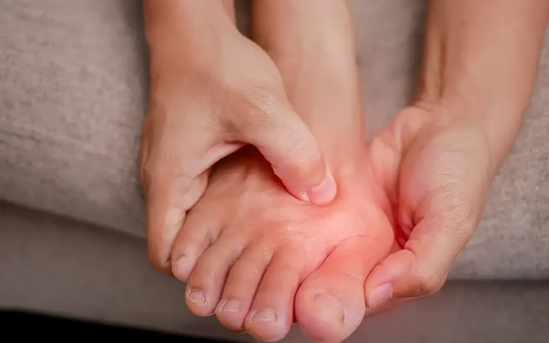 Can Bunions Be Treated Without Surgery?