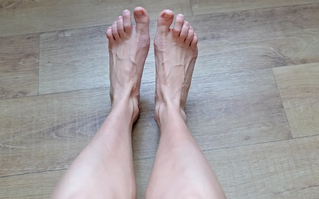 Pain at the Top of the Foot: Common Causes and Remedies