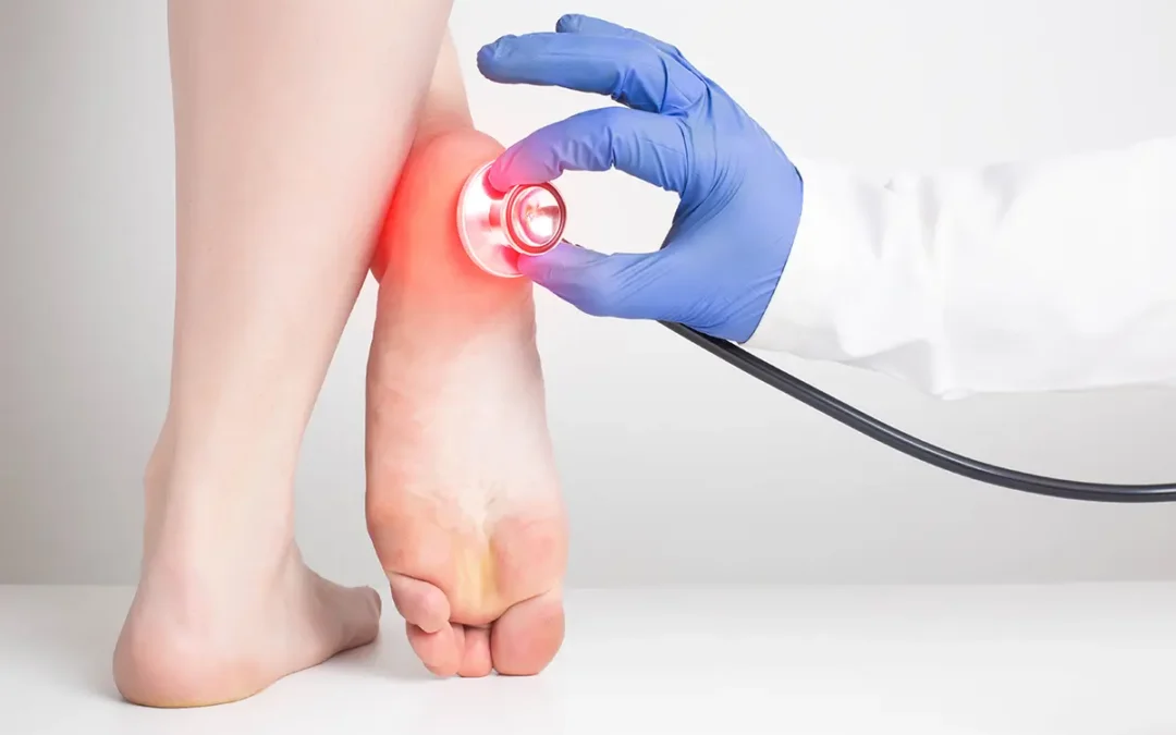 Causes of Tarsal Tunnel Syndrome: What’s Behind the Pain?