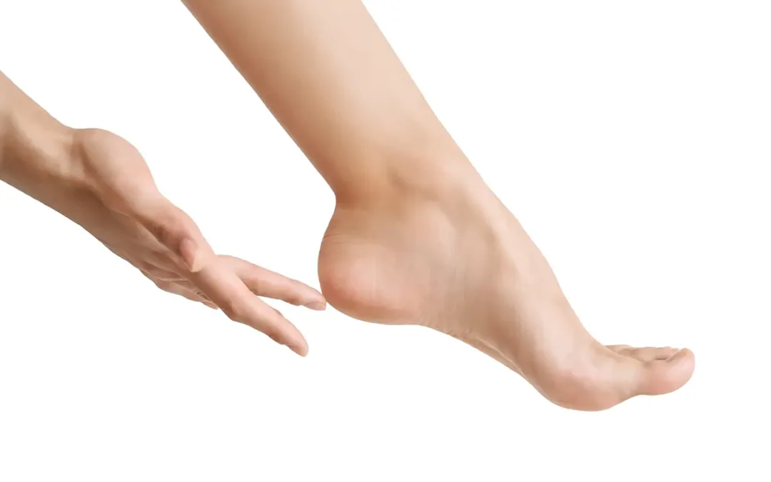How to Prevent Heel Fissures and Keep Your Feet Smooth