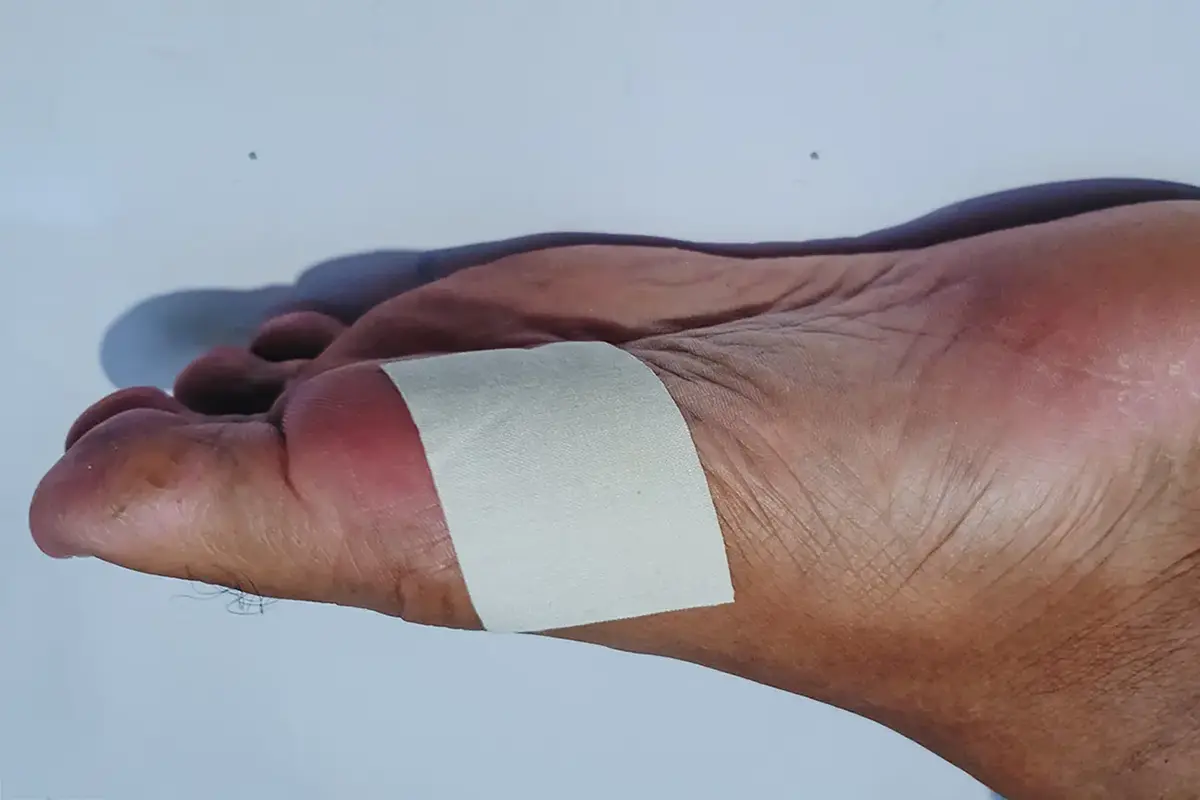 the patch helps with foot injuries and protects the wound from dirt