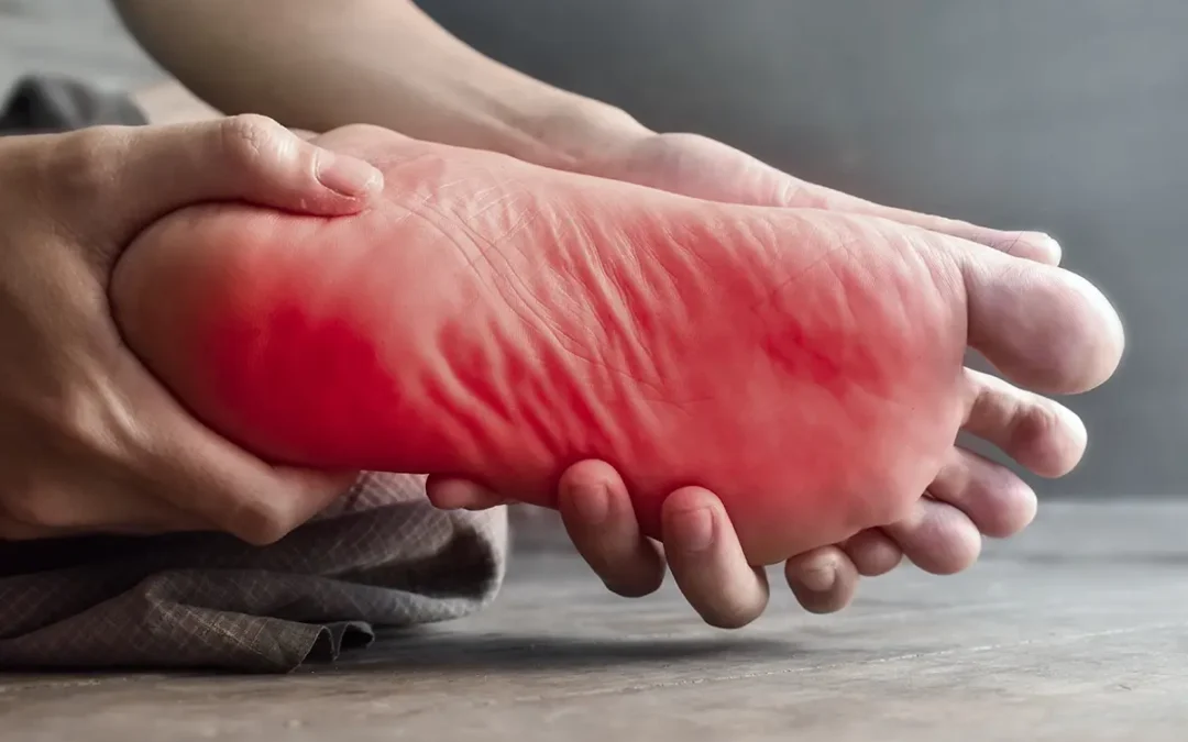 Everything You Need to Know About Plantar Fasciitis