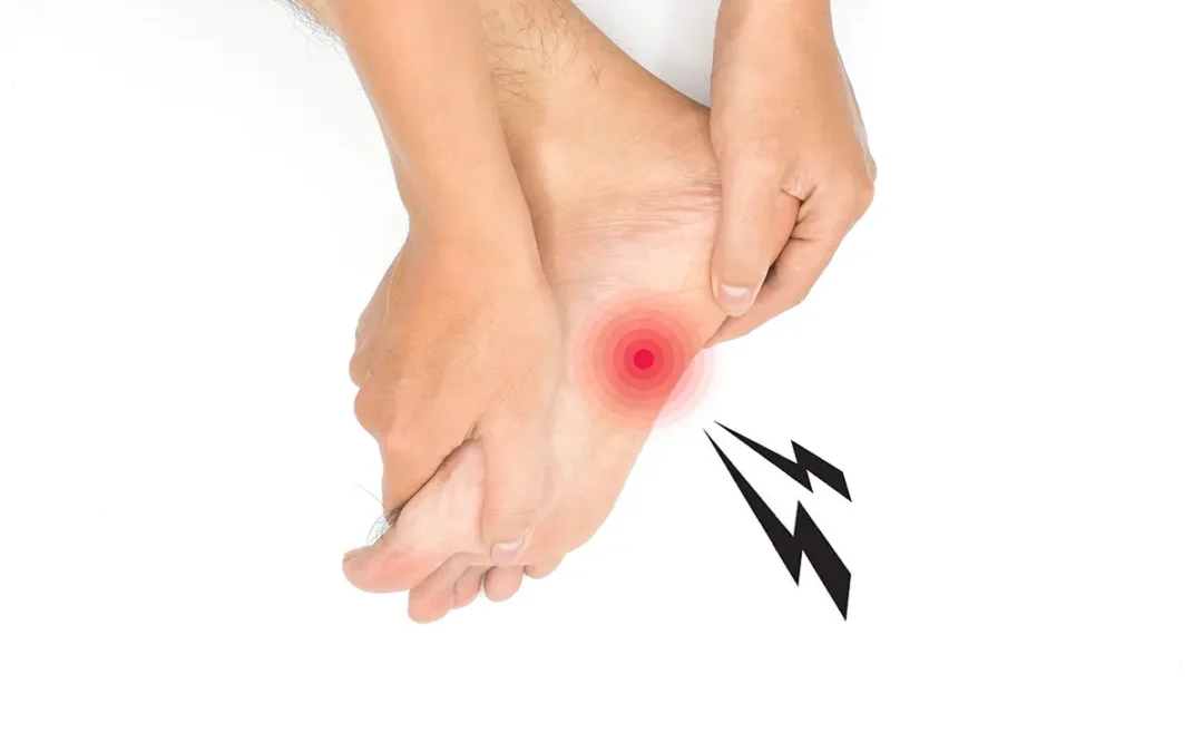How to Recognize Early Signs of Plantar Fasciitis Before It Worsens