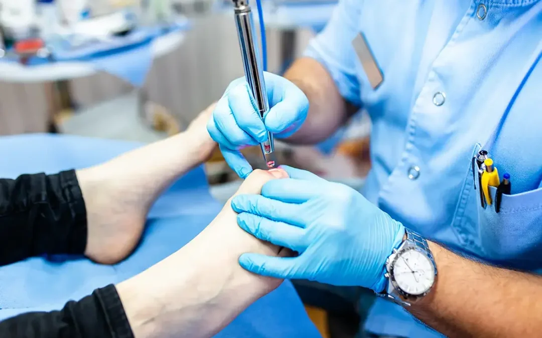 Laser Therapy and Toenail Fungus: A Modern Treatment Option